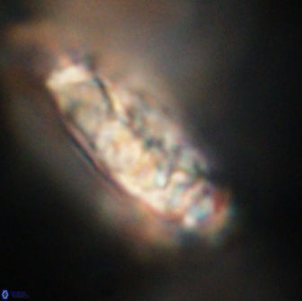Cervisiella polymegalo 64893