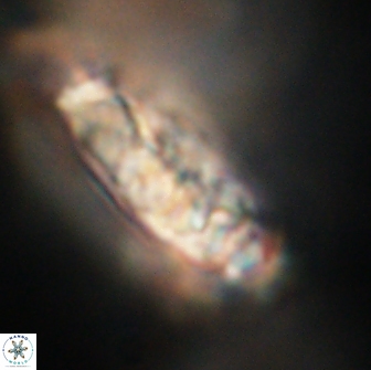 Cervisiella polymegalo 64893