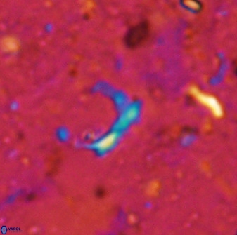 Ceratolithina naturalisteplateauensis 42364