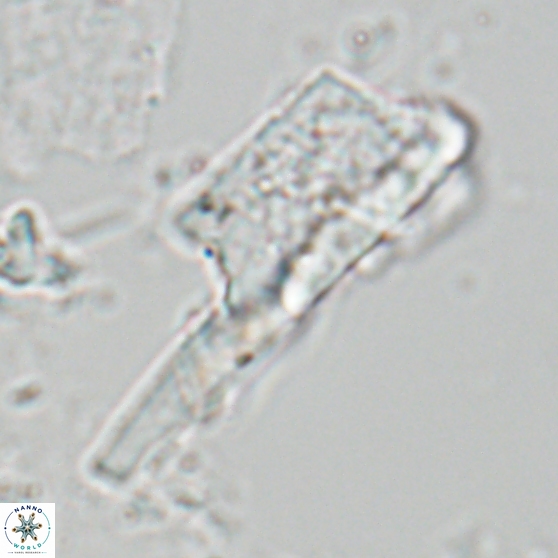 Ceratolithina copis 18587