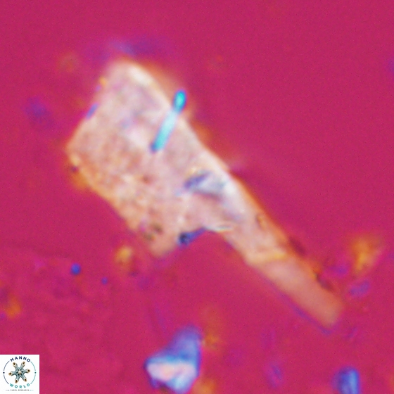 Ceratolithina copis 18582