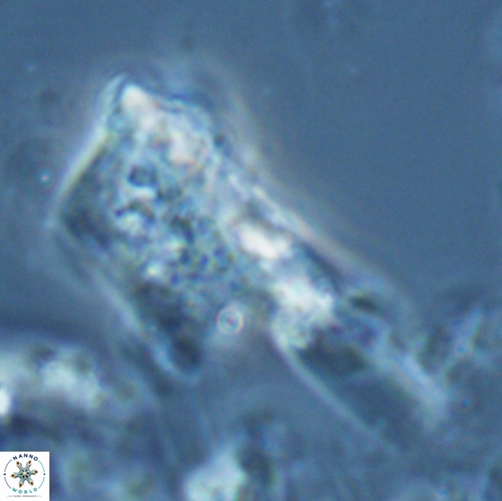 Ceratolithina copis 18590