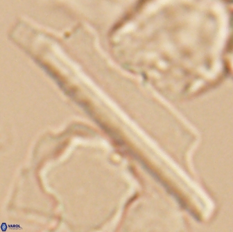 Ceratolithina copis 13044