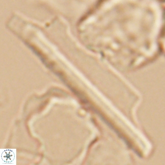Ceratolithina copis 13044