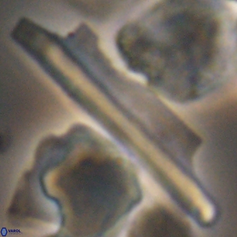 Ceratolithina copis 13043