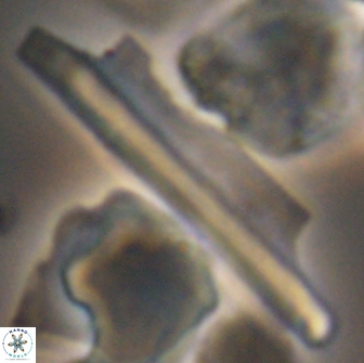 Ceratolithina copis 13043