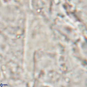 Ceratolithina cruxii 17655