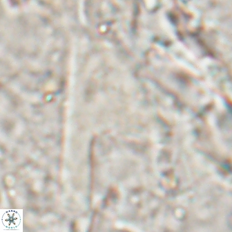 Ceratolithina cruxii 17655