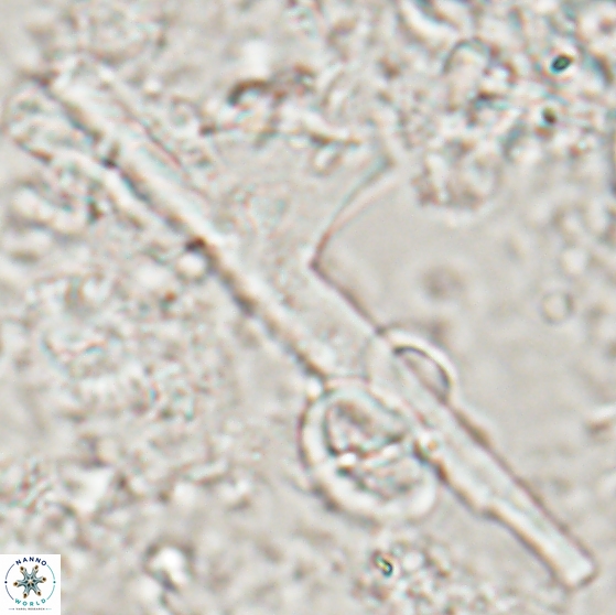 Ceratolithina cruxii 17625
