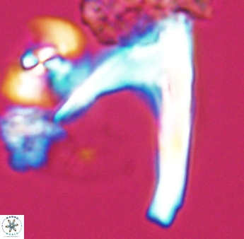Ceratolithina hamata falcata 9073