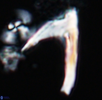 Ceratolithina hamata falcata 9074