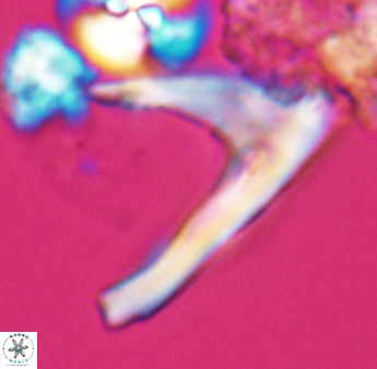 Ceratolithina hamata falcata 9076