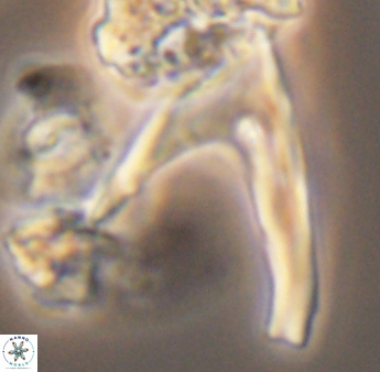 Ceratolithina hamata falcata 9077