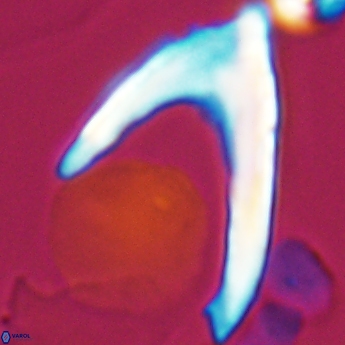 Ceratolithina hamata falcata 9349