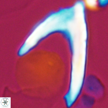 Ceratolithina hamata falcata 9349