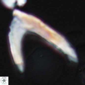 Ceratolithina hamata falcata 9351
