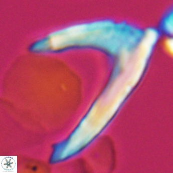 Ceratolithina hamata falcata 9353