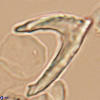 Ceratolithina hamata falcata 9354