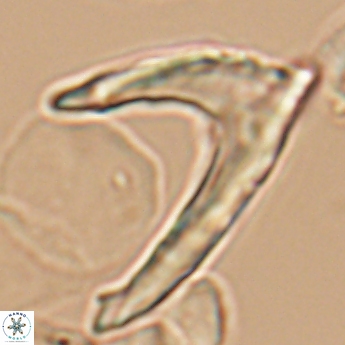 Ceratolithina hamata falcata 9354