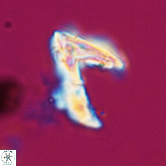 Ceratolithina hamata hamata 24579