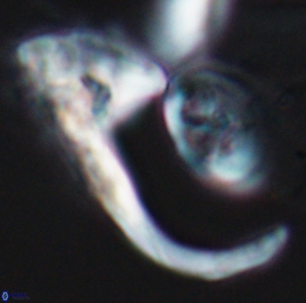 Ceratolithina hamata hamata 9315