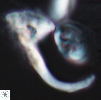 Ceratolithina hamata hamata 9315
