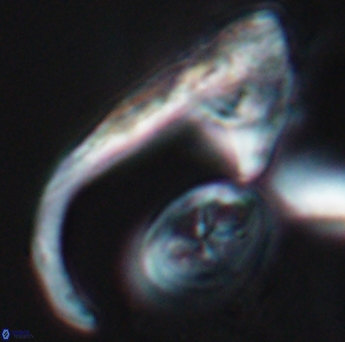 Ceratolithina hamata hamata 9319