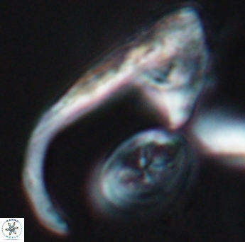 Ceratolithina hamata hamata 9319
