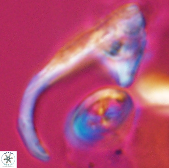 Ceratolithina hamata hamata 9320