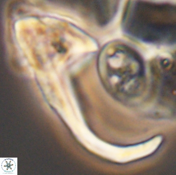 Ceratolithina hamata hamata 9321