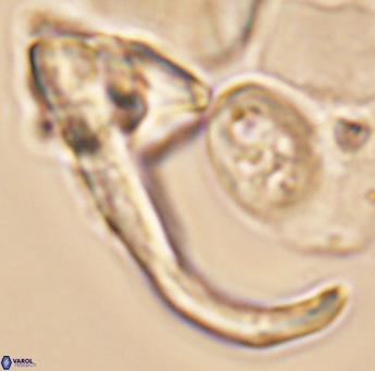 Ceratolithina hamata hamata 9322