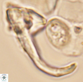 Ceratolithina hamata hamata 9322