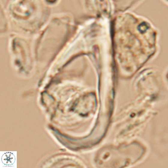 Ceratolithina hamata hamata 9497