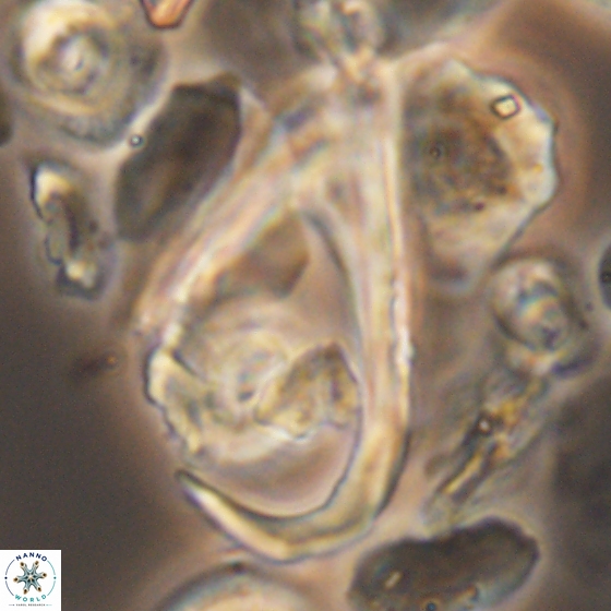 Ceratolithina hamata hamata 9498