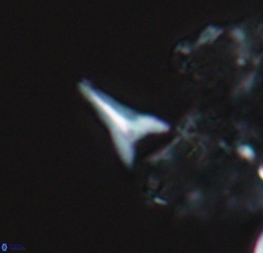 Ceratolithoides aculeus 10440