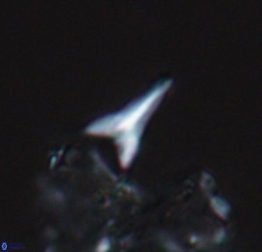 Ceratolithoides aculeus 10441