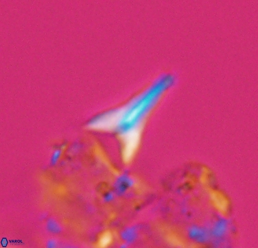 Ceratolithoides aculeus 10442