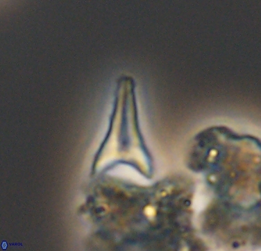 Ceratolithoides aculeus 10435