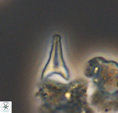 Ceratolithoides aculeus 10435