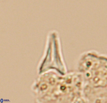 Ceratolithoides aculeus 10436