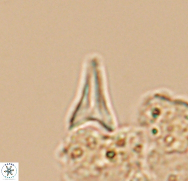 Ceratolithoides aculeus 10436