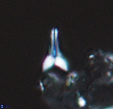 Ceratolithoides aculeus 10437