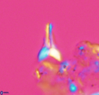 Ceratolithoides aculeus 10438