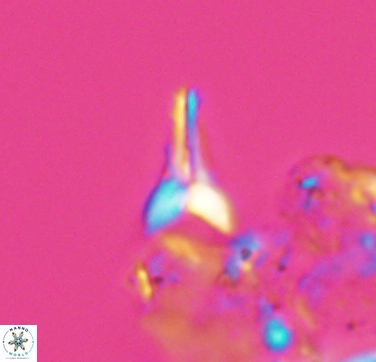 Ceratolithoides aculeus 10438