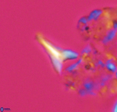 Ceratolithoides aculeus 10439