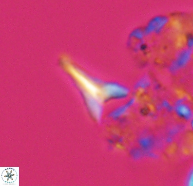 Ceratolithoides aculeus 10439