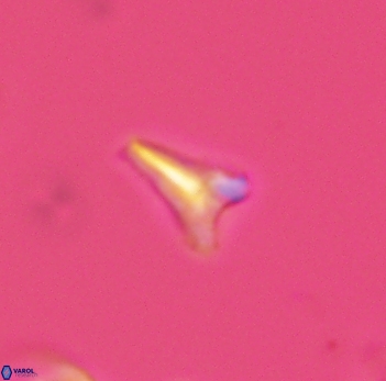 Ceratolithoides aculeus 3935