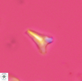 Ceratolithoides aculeus 3935