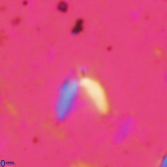 Ceratolithoides kamptneri 1662