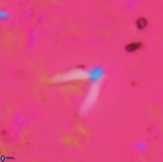 Ceratolithoides kamptneri 1663